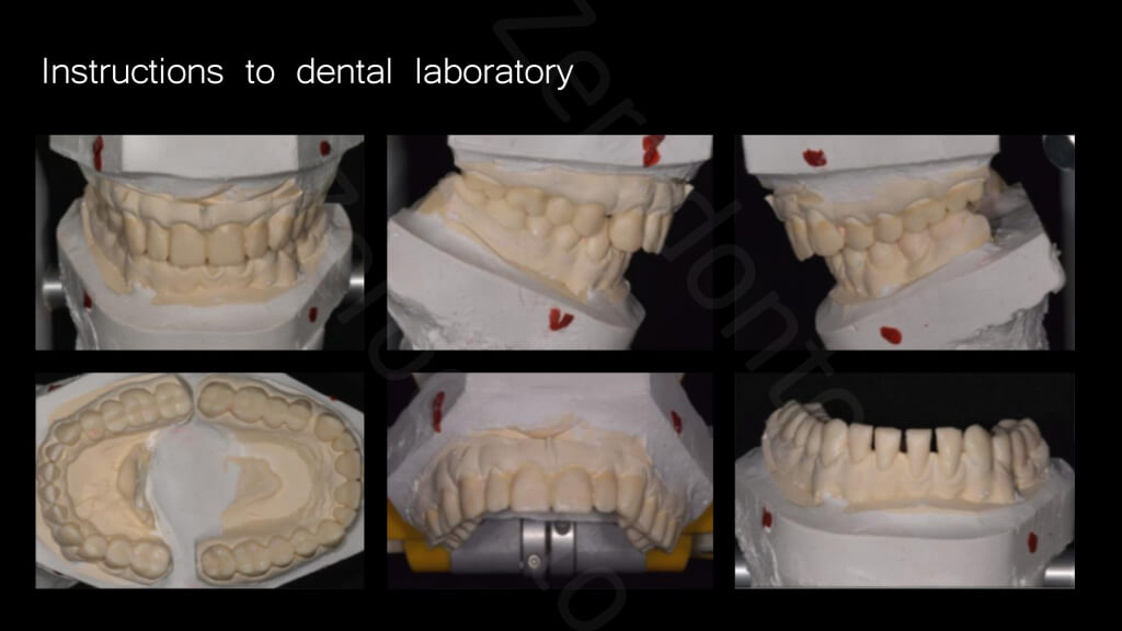 010_instructions_to_dental_laboratory