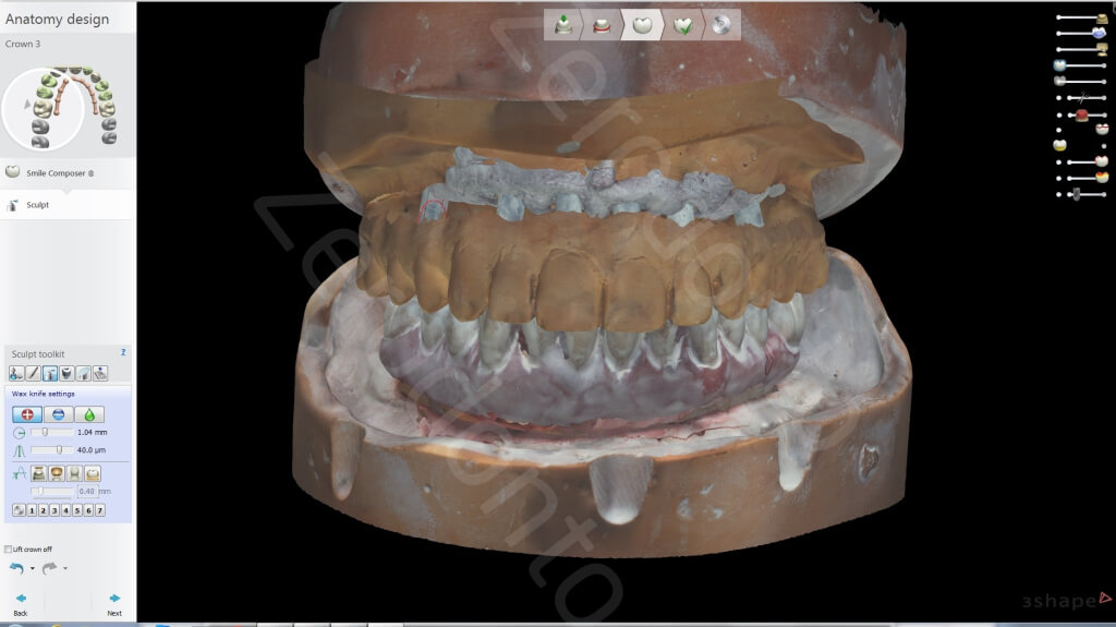 11. Lab scan1