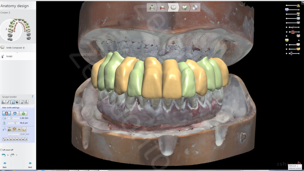 12. Lab scan2