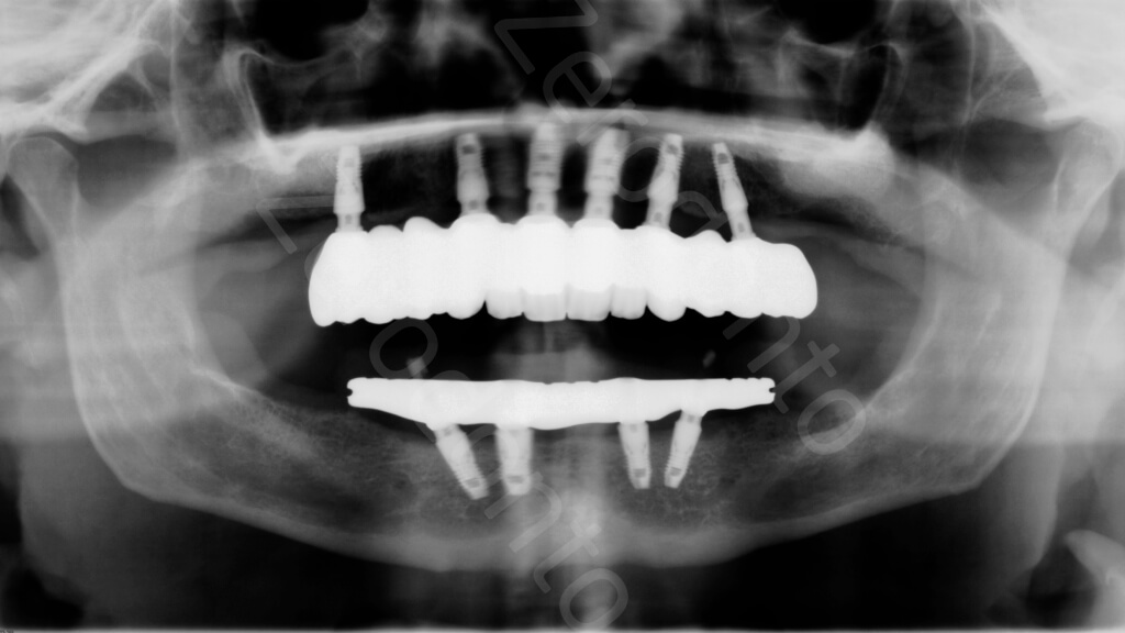 26. Panoramic radiograph