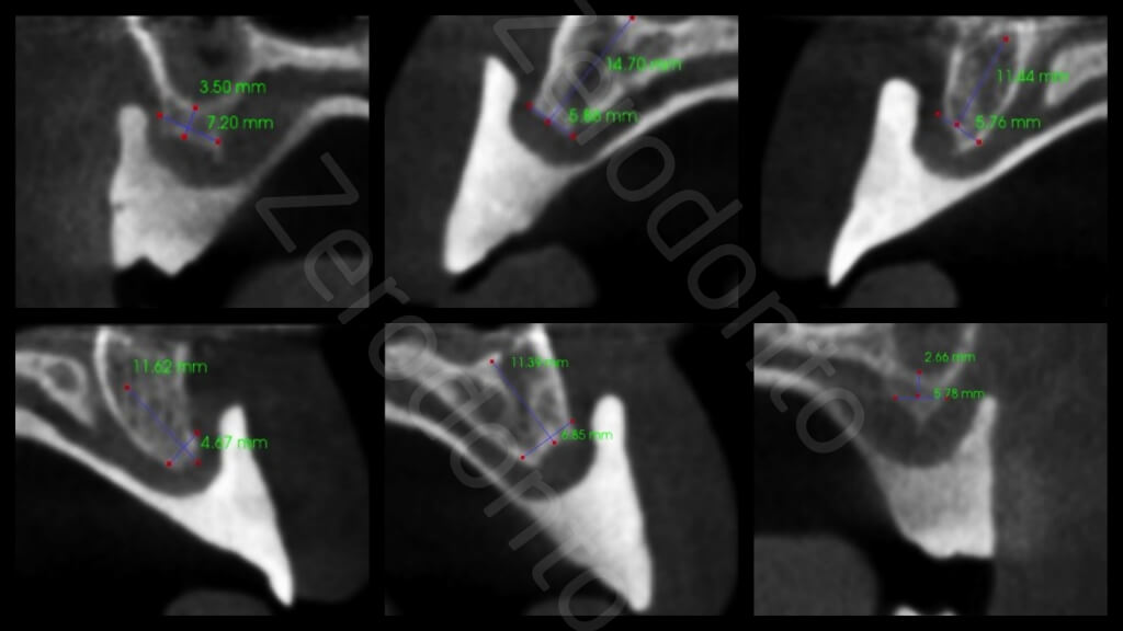 3. CBCT image