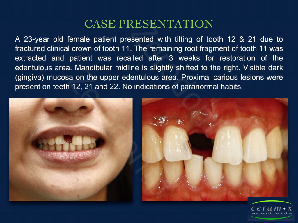 Diapositiva06