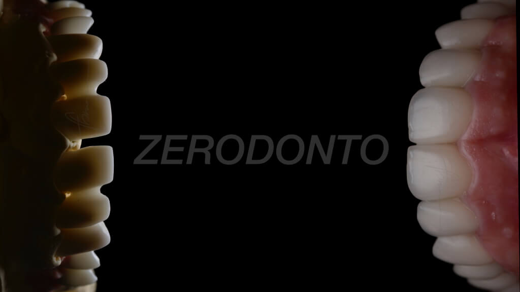 ZERODONTO.025