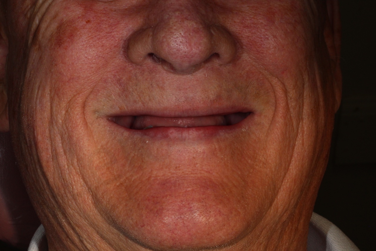 A 75-year-old male patient 1