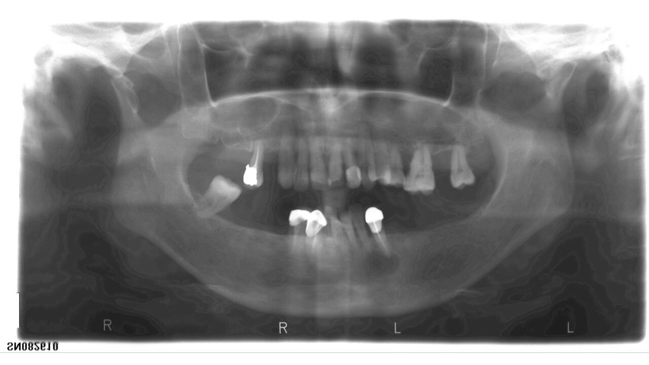 Diapositiva04