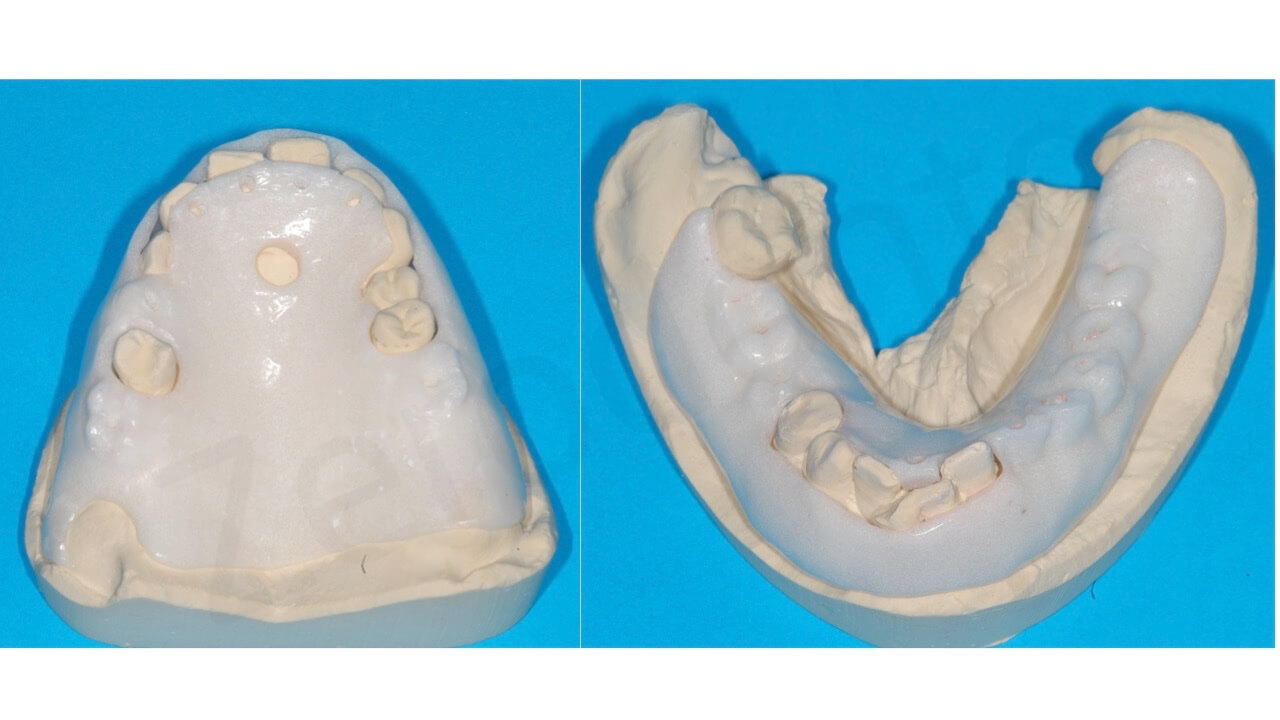 Diapositiva06