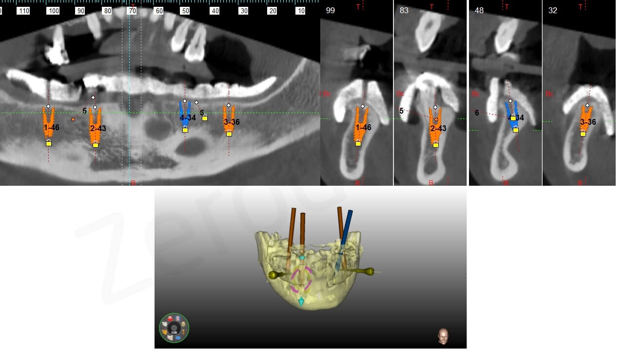 Diapositiva07