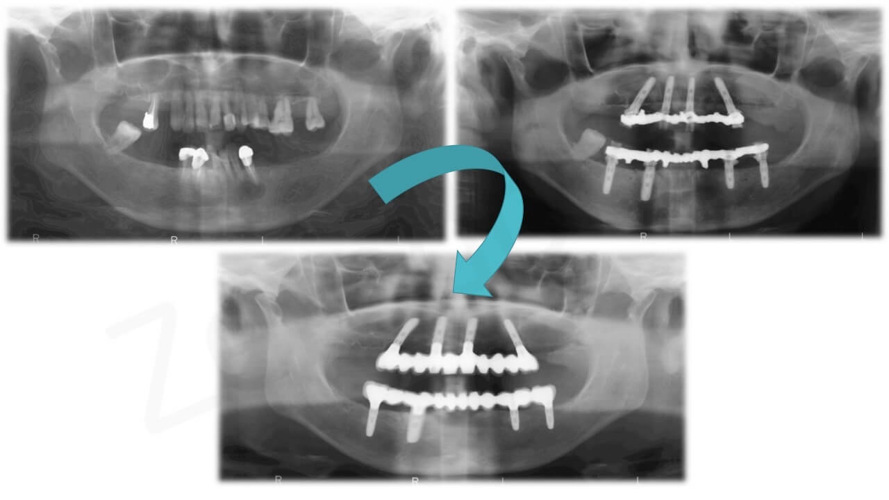 Diapositiva18