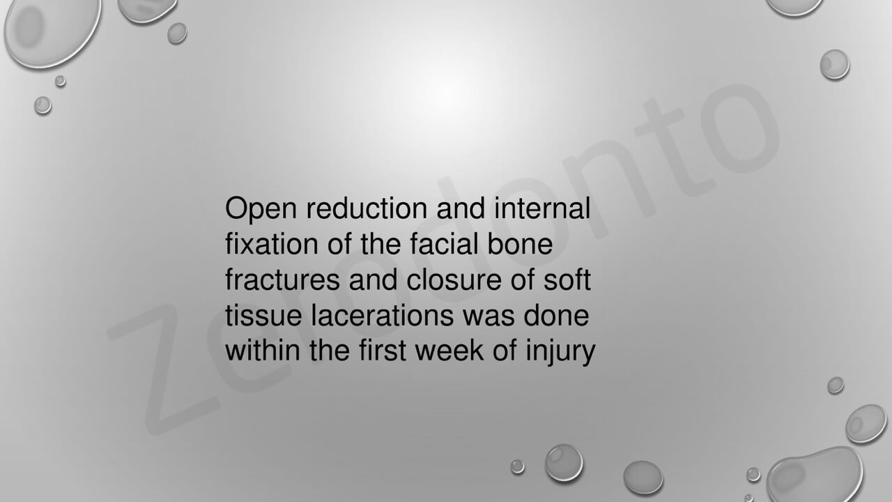 Niel Grundling Rehabilitation of a midface injury (2)-05