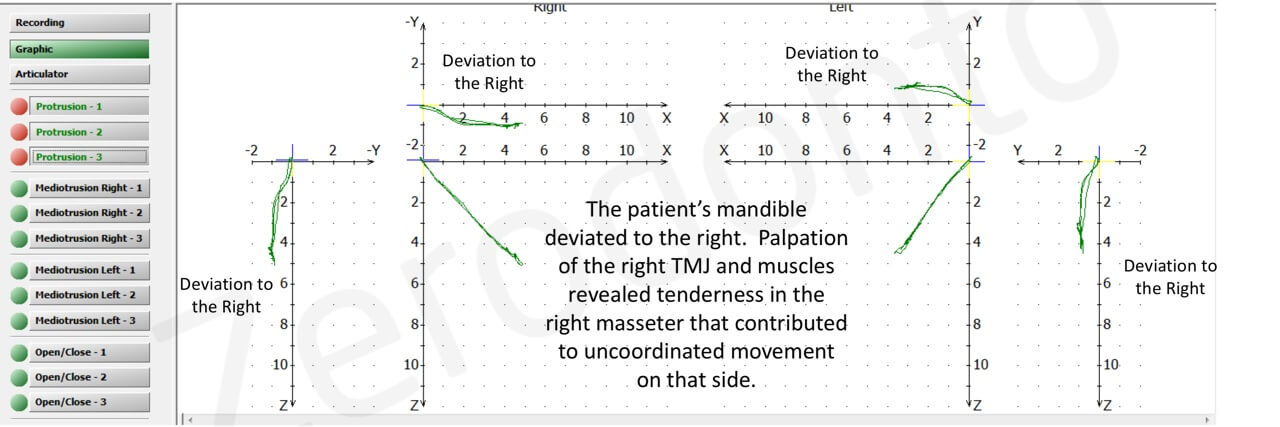 Slide11